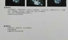 深圳宫外孕爆料新闻报道